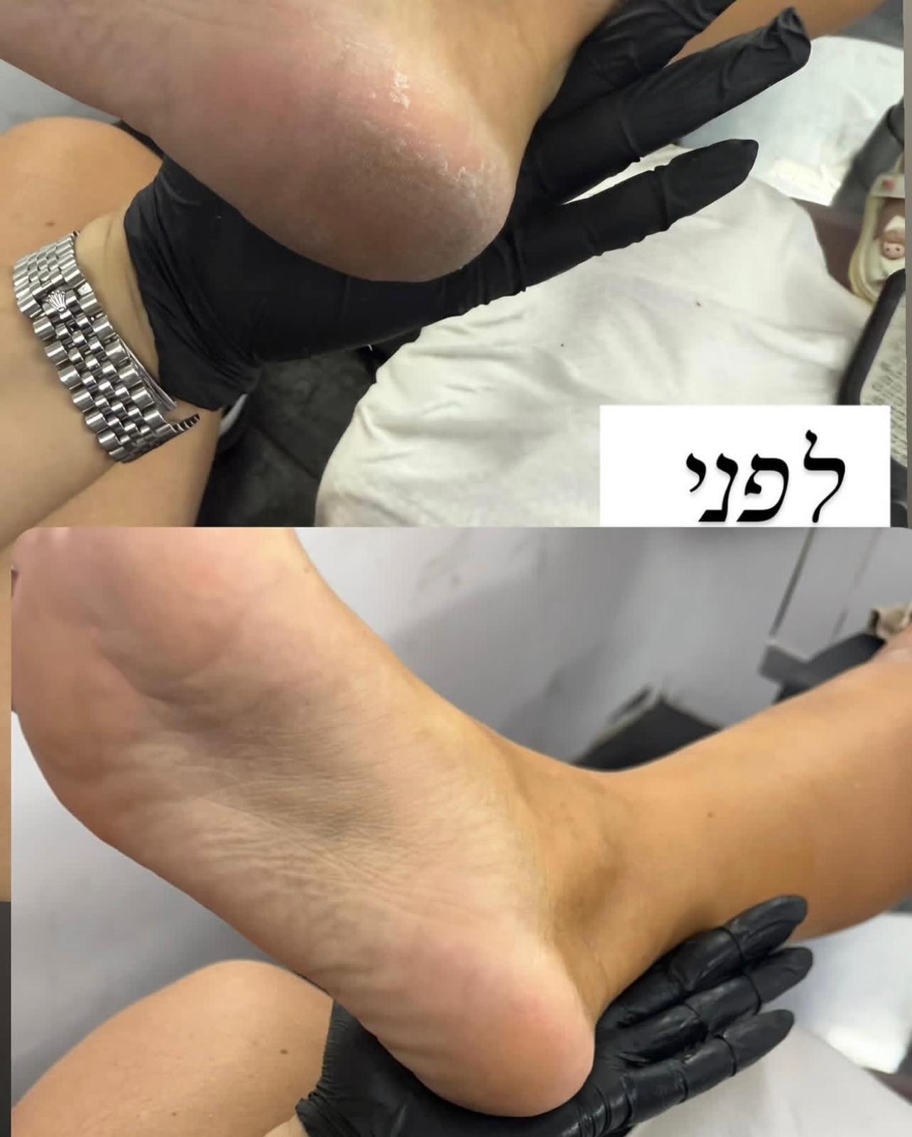 פדיקור קלאסי